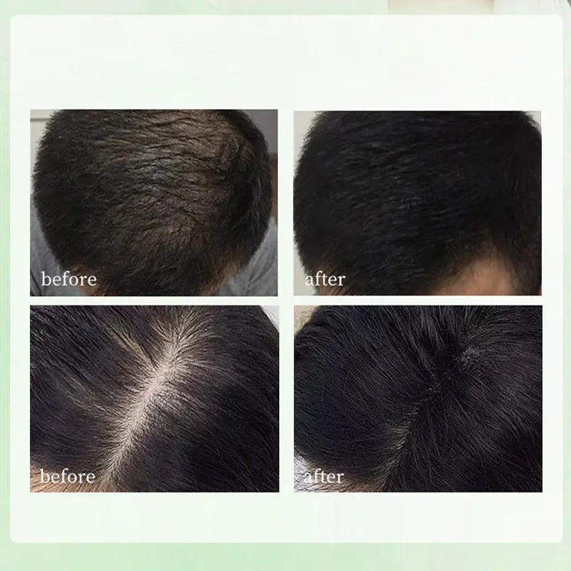 Natural Herbal Shampoo Soap Usman Grass Handmade Soap Hair Nourishing