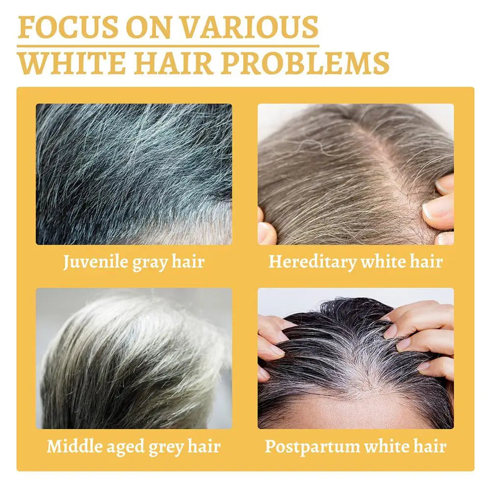 Gray White Hair Treatment Serum White To Black Natural Hair