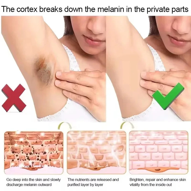 Body Whitening Bleach Cream Brighten Underarm Elbow Knees