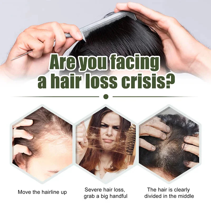 Hair Loss Treatment Spray For Man Women 60ML