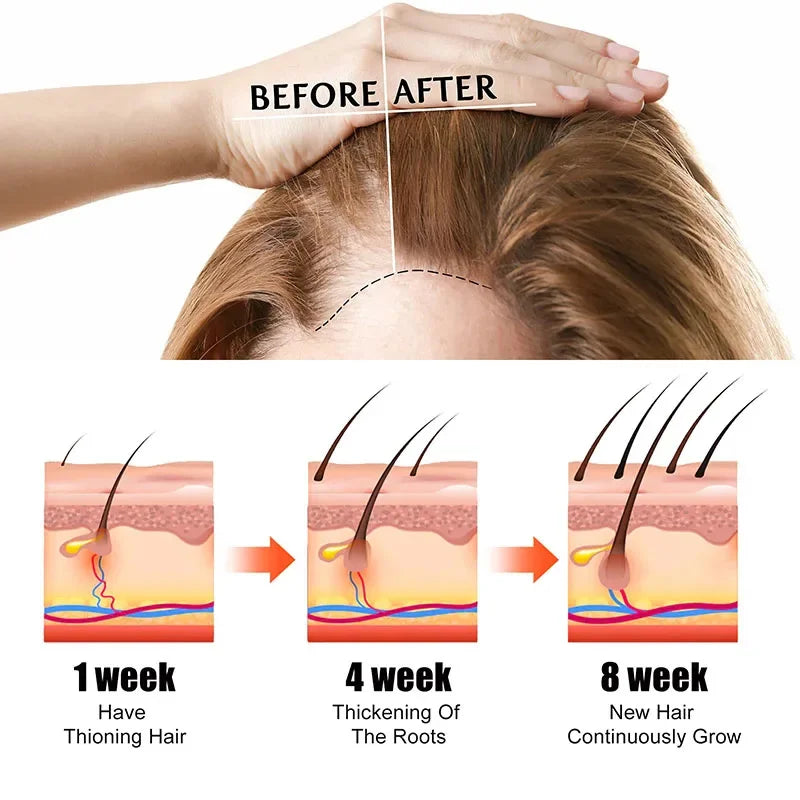 Hair Loss Treatment Spray For Man Women 60ML