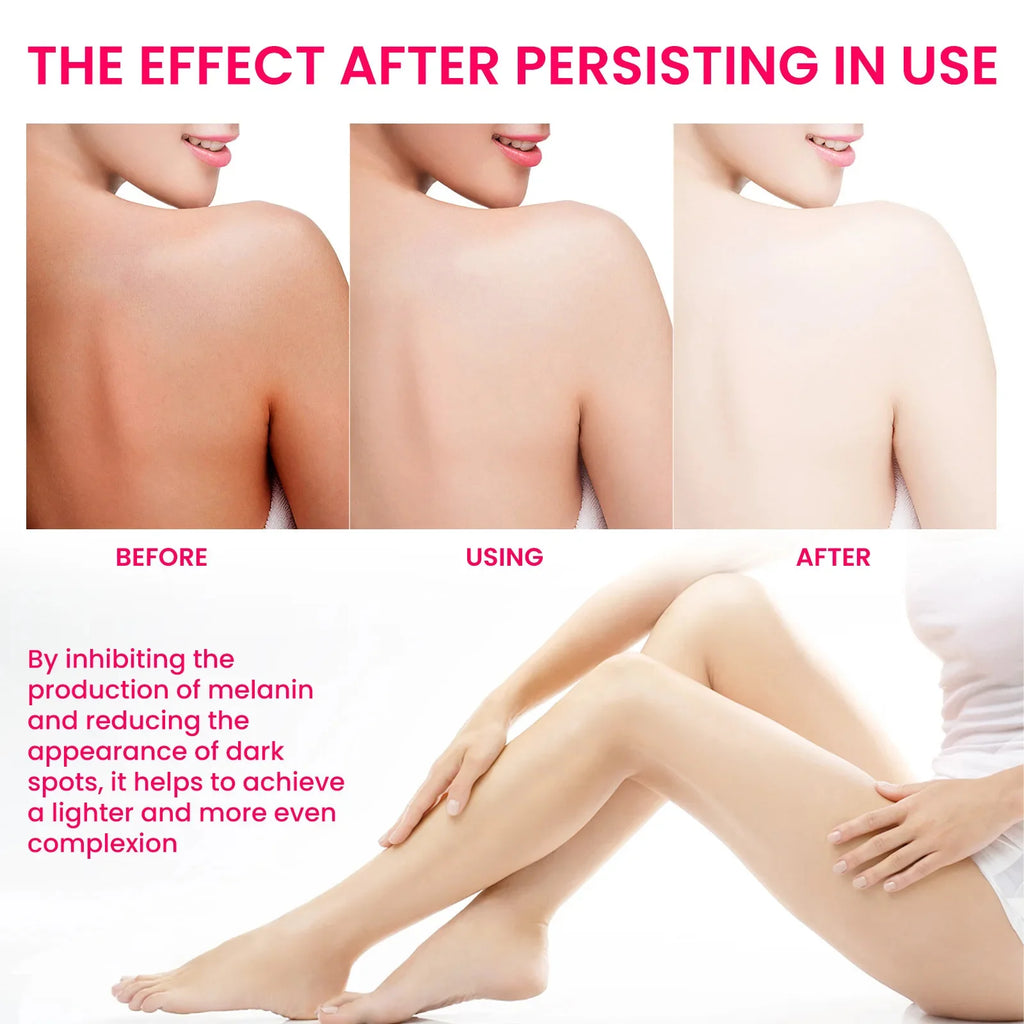 Body Whitening Bleach Cream Brighten Underarm Elbow Knees