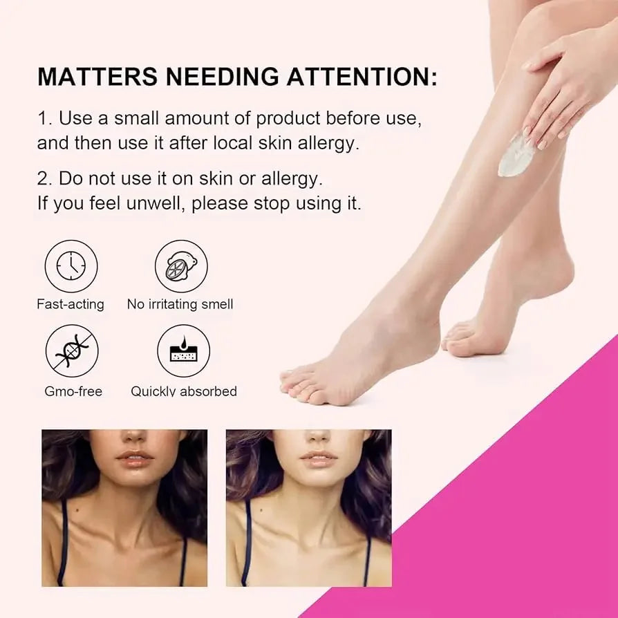 Body Whitening Bleach Cream Brighten Underarm Elbow Knees