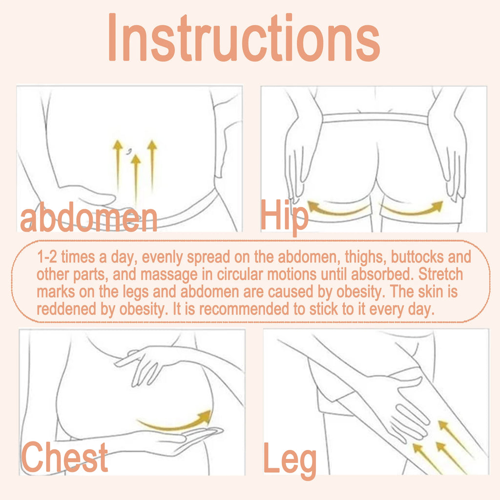 Remove stretch marks cream, promote cell regeneration, increase fiber elasticity