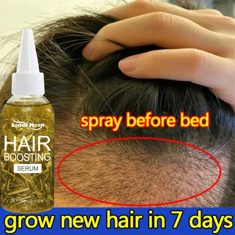Hair Loss Treatment Spray For Man Women 60ML