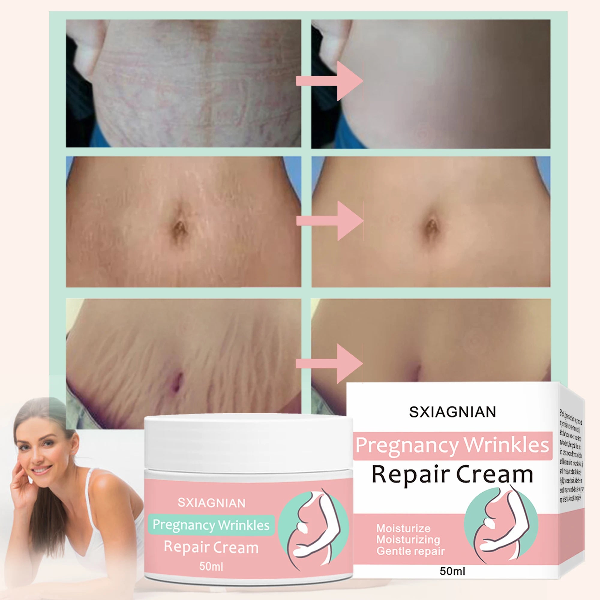Remove stretch marks cream, promote cell regeneration, increase fiber elasticity
