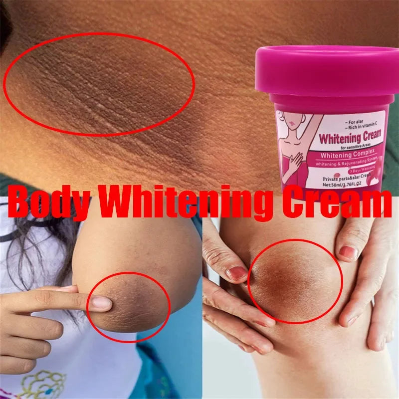 Body Whitening Bleach Cream Brighten Underarm Elbow Knees