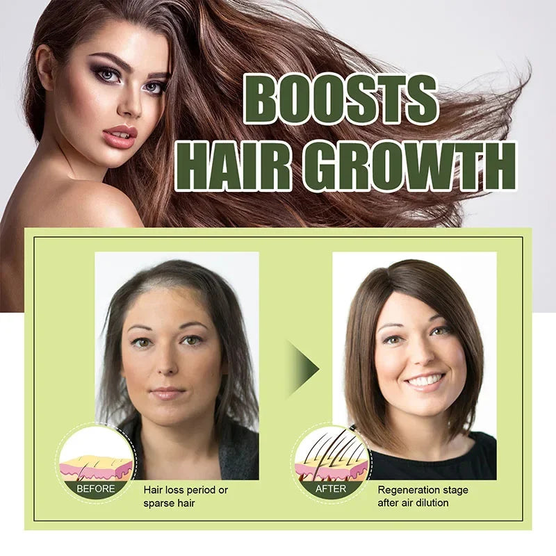 Hair Loss Treatment Spray For Man Women 60ML