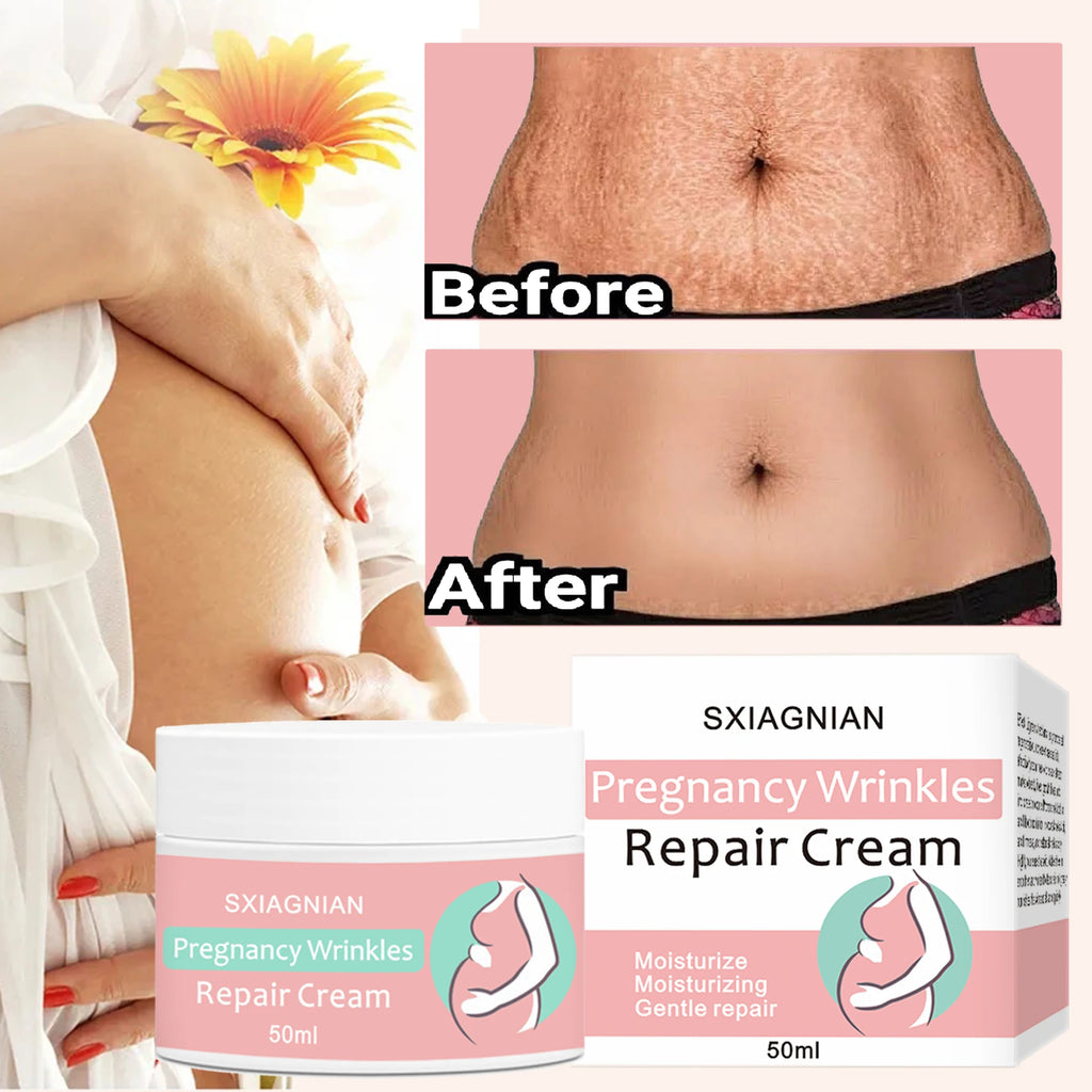 Remove stretch marks cream, promote cell regeneration, increase fiber elasticity