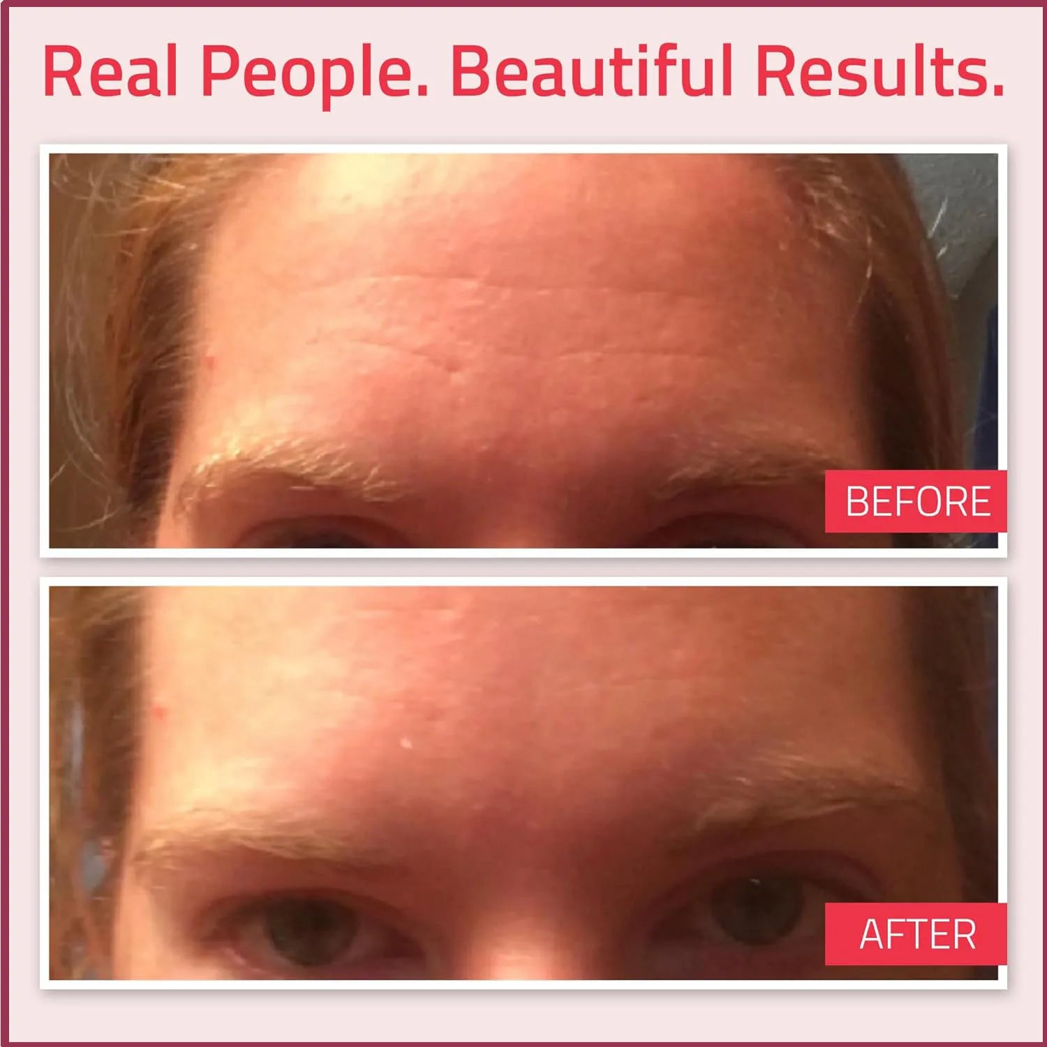 Retinol Body Lotion Firming For Face, Body, Dry Skin Improves Elasticity Age Rewind Serum For Face Serum Brightening