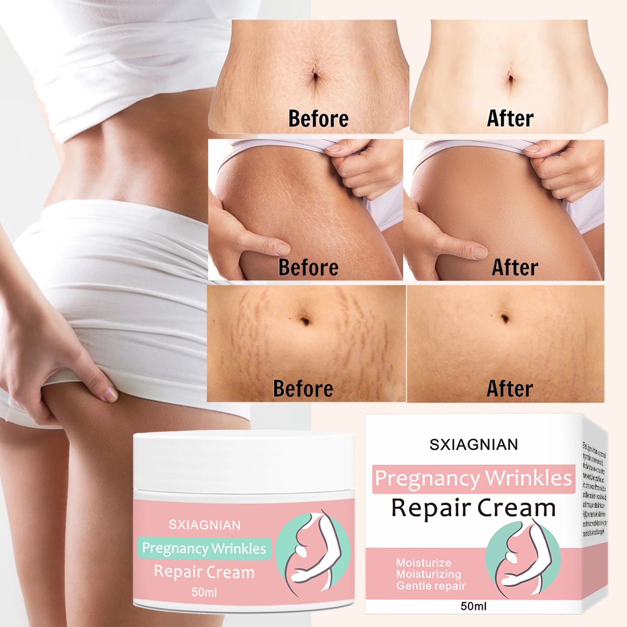 Remove stretch marks cream, promote cell regeneration, increase fiber elasticity