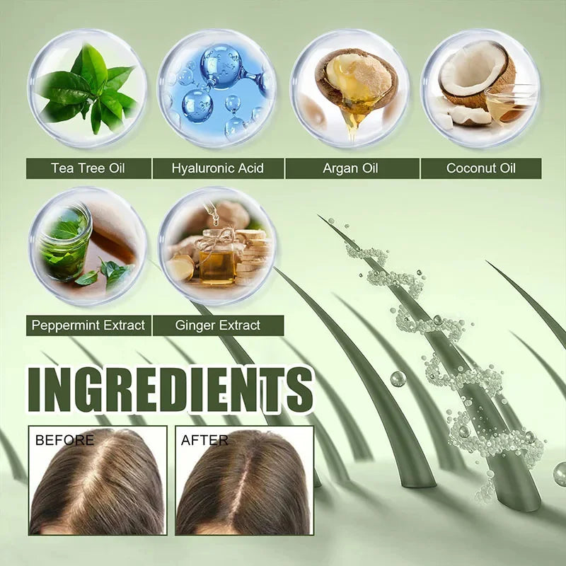 Hair Loss Treatment Spray For Man Women 60ML