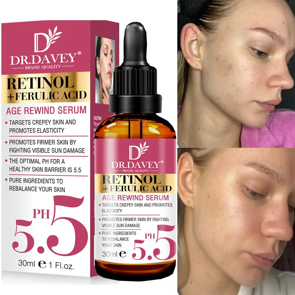 Retinol Body Lotion Firming For Face, Body, Dry Skin Improves Elasticity Age Rewind Serum For Face Serum Brightening