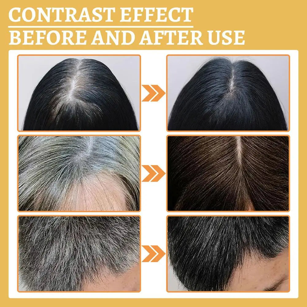Gray White Hair Treatment Serum White To Black Natural Hair