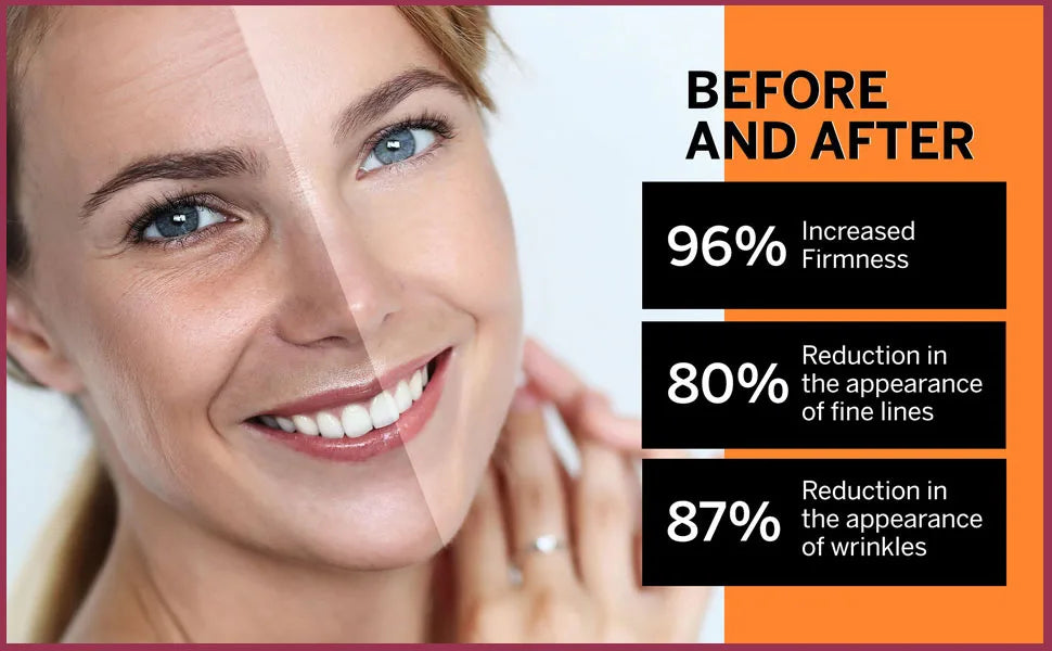 Retinol Body Lotion Firming For Face, Body, Dry Skin Improves Elasticity Age Rewind Serum For Face Serum Brightening