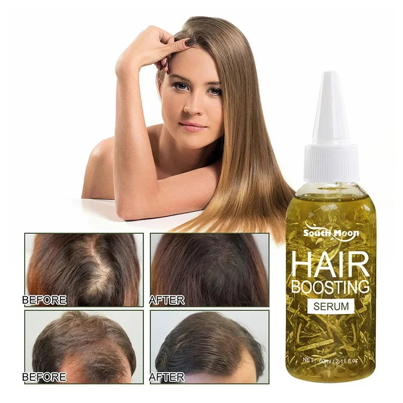 Hair Loss Treatment Spray For Man Women 60ML