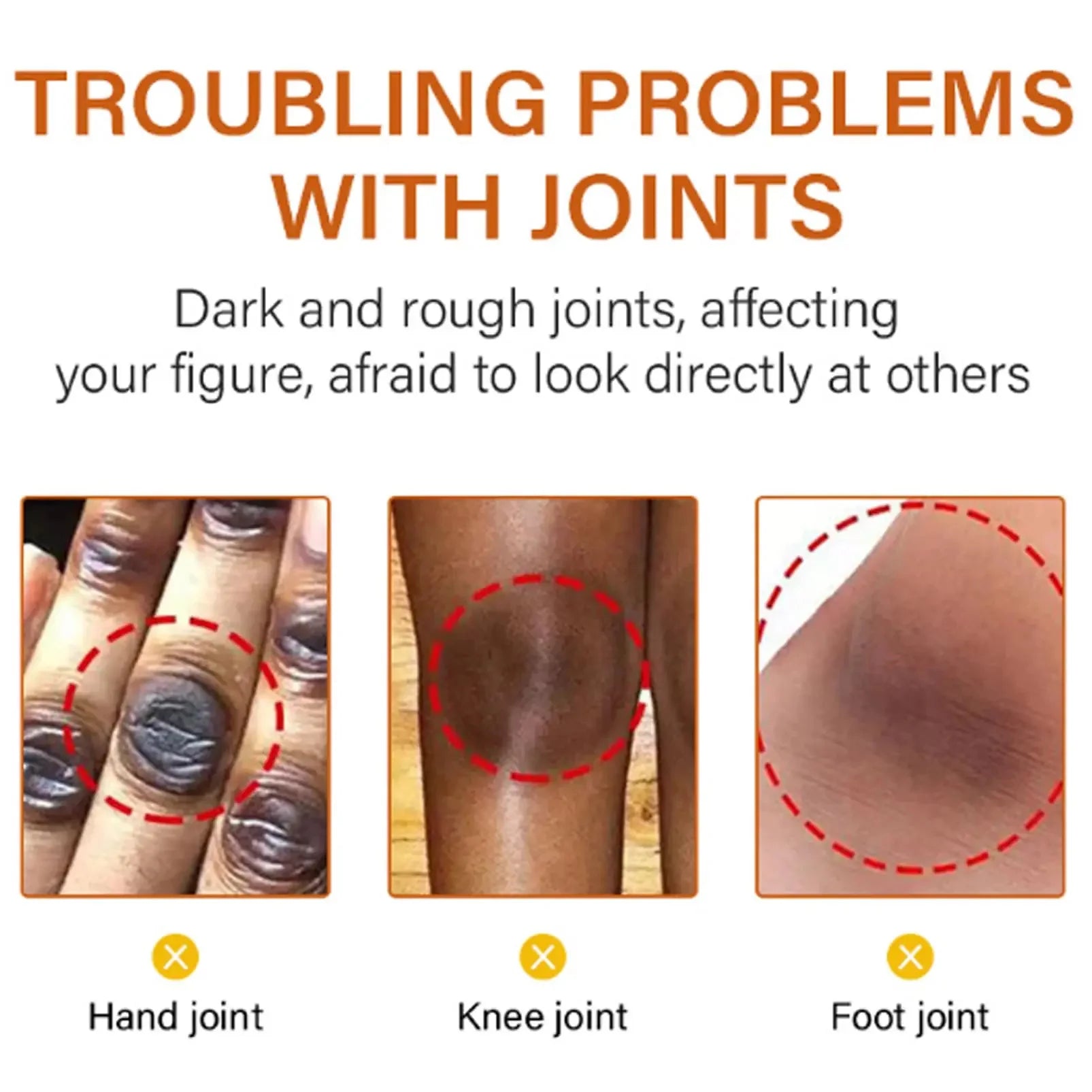 Body Whitening Bleach Cream Brighten Underarm Elbow Knees