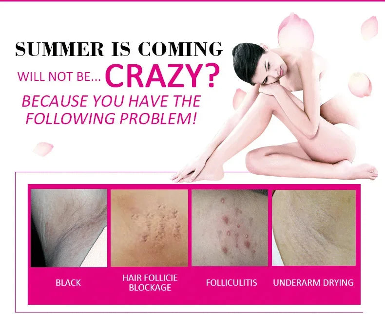 Body Whitening Bleach Cream Brighten Underarm Elbow Knees