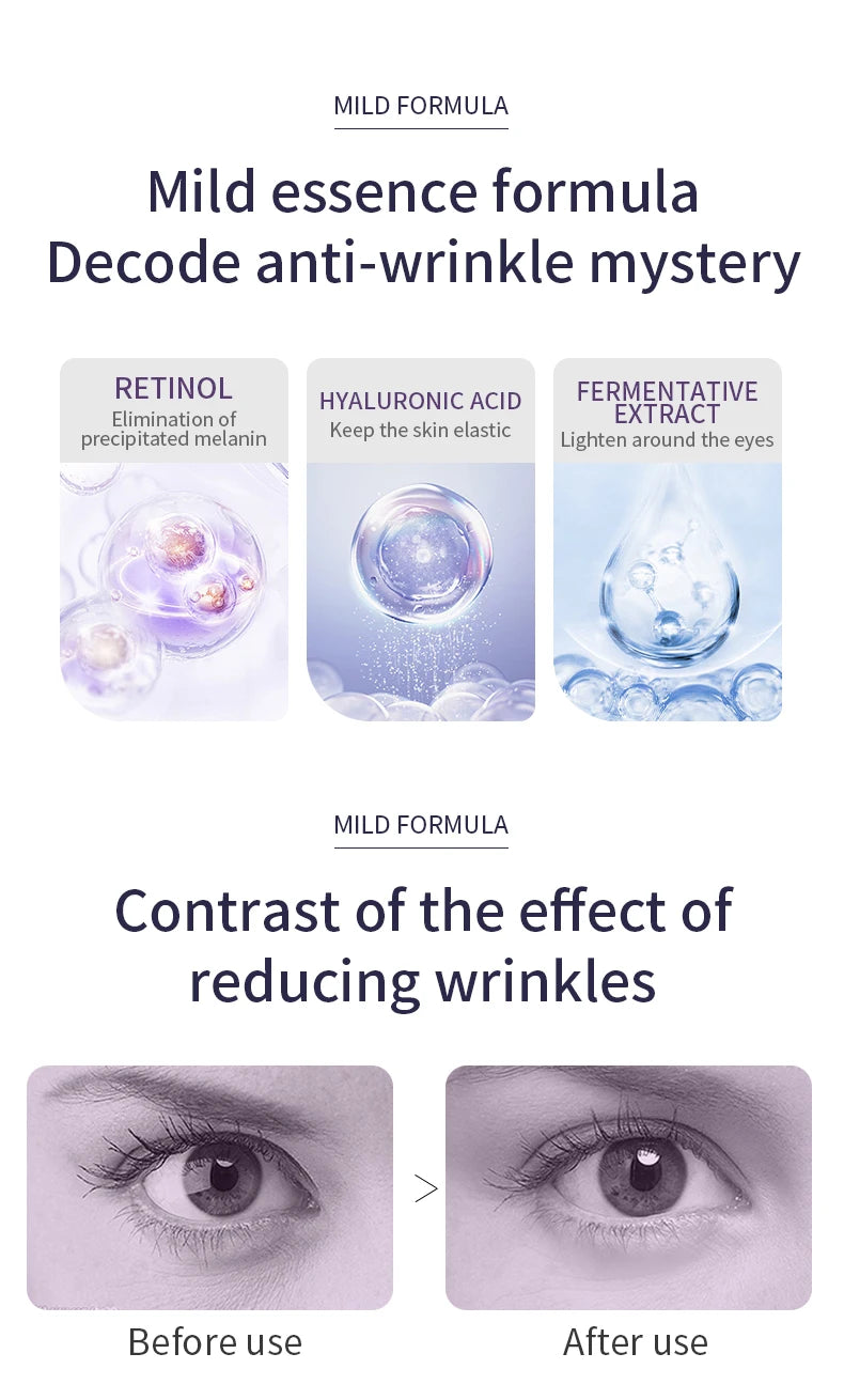 Anti Wrinkle Anti Dark Circle Eye Cream Roller